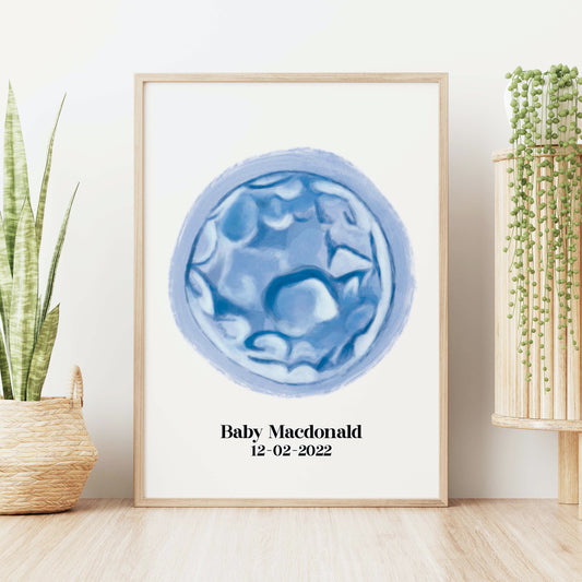 CUSTOM IVF Embryo Portrait Wall Print