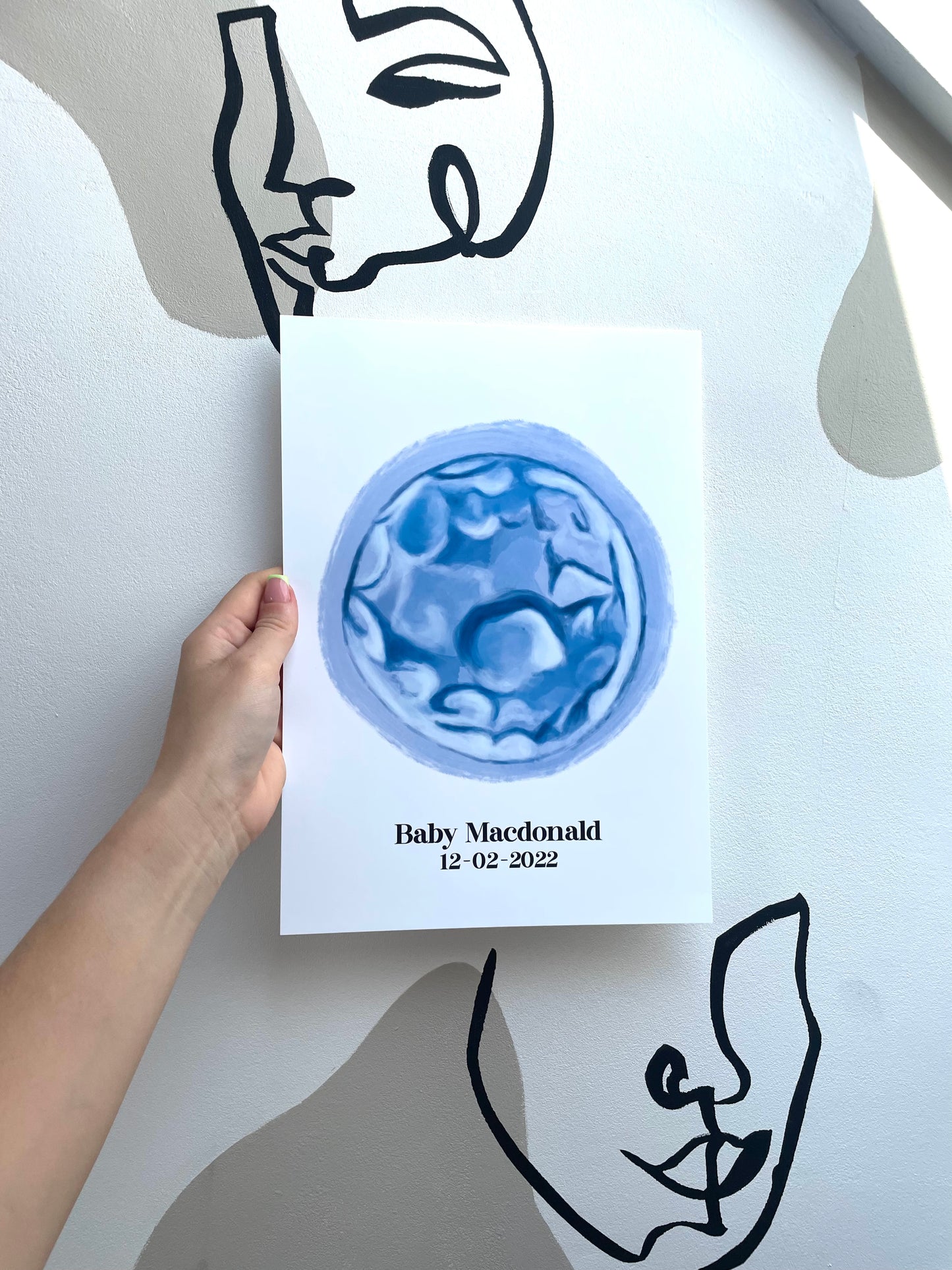 CUSTOM IVF Embryo Portrait Wall Print
